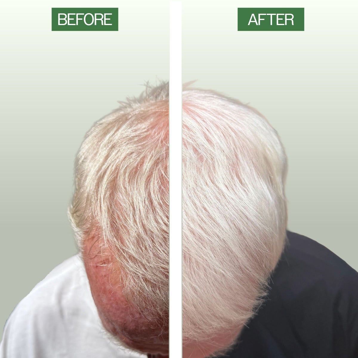 A split-screen before-and-after comparison showing the difference that REUZEL Rosemary Mint Hair and scalp serum can make. Image shows top of a person's head, with sparse, red scalp visible on the left and fuller, lighter hair on the right. Green labels at the top read BEFORE and AFTER. 